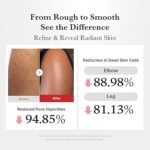 Medicube - Hypochlorous Acid Body Peel Shot - 280ml – Image 3